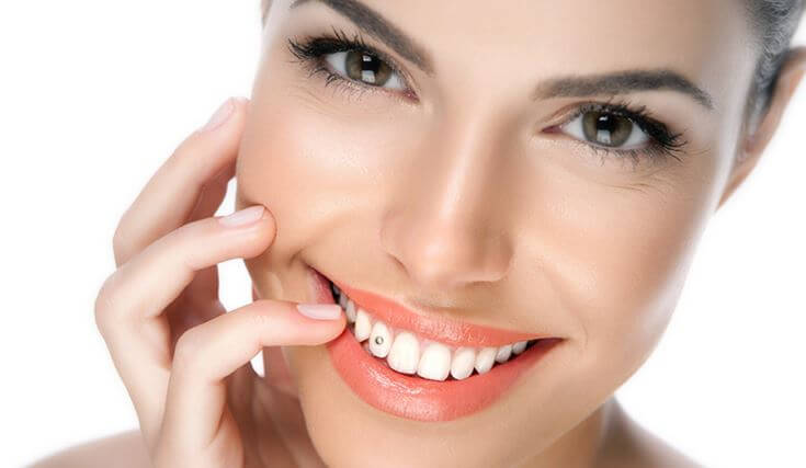 Brillantino sul dente prezzo