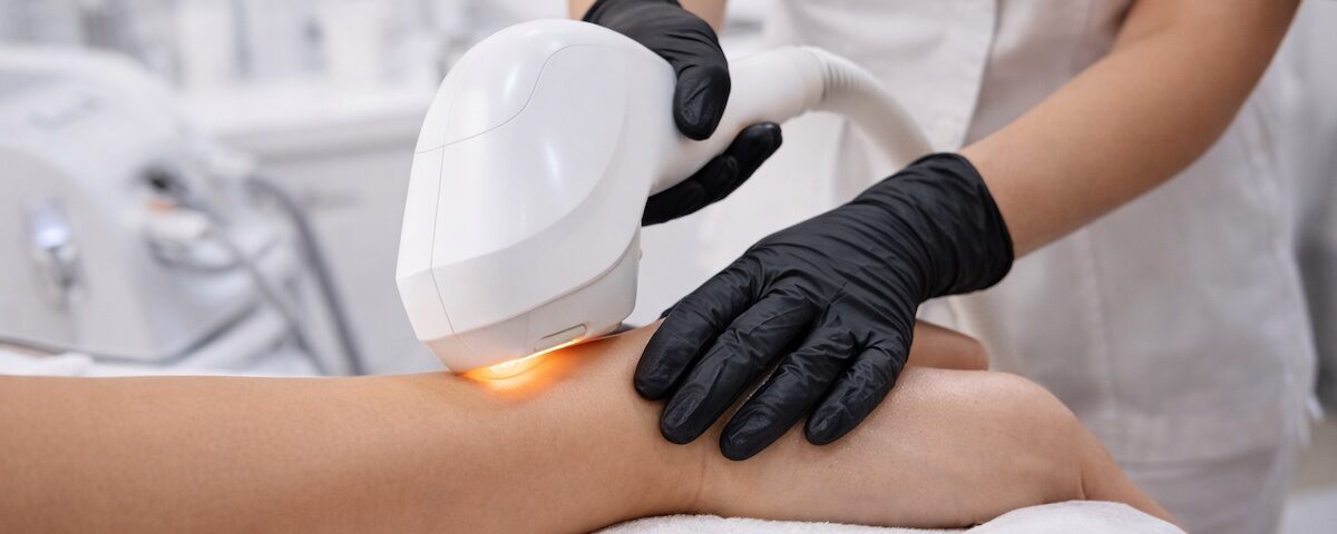 Trattamento di depilazione laser su gamba in centro estetico con operatore e guanti
